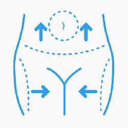 Aesthetic Body Surgery Costa Rica