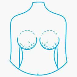Breast Surgery in Costa Rica